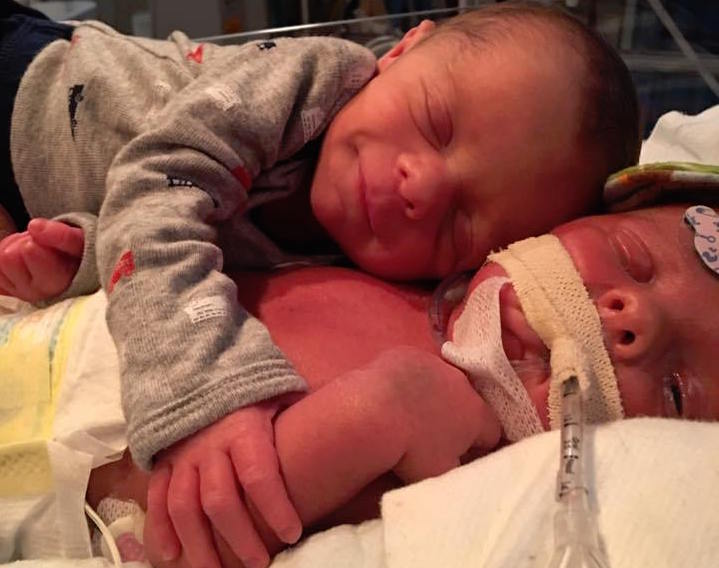 Neonato abbraccia il gemello malato. La foto commuove il web