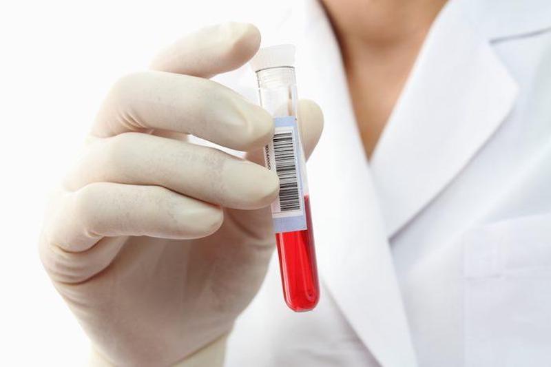 Studiosi: 'pronto test del sangue per la diagnosi precoce dei tumori'